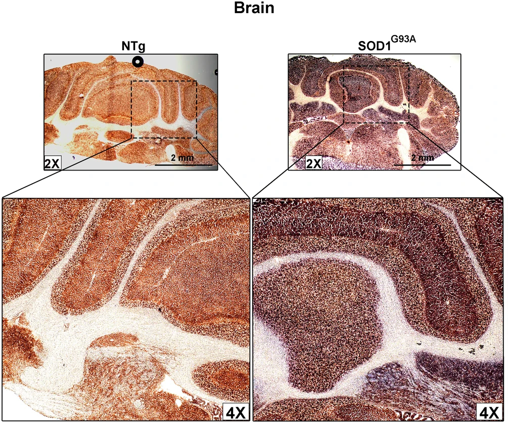 Defects in mitochondrial respiratory complexes in brain tissues from ALS model transgenic mice. Cytochrome c oxidase (COX) and succinate dehydrogenase (SDH) activities are shown by double staining in sections of the cerebellum from mutant (SOD1G93A) and control (NTg) mice. In control sections, the purple stain representing SDH activity is masked by the brown stain representing COX activity, whereas the purple stain is prominently visible in mutant tissues. This suggests that COX activity is reduced in mutan