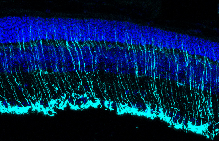 Sección de la retina de un modelo de ratón de retinosis pigmentaria. Los núcleos se tiñen de azul. GFAP (cian) en células gliales de Muller y gliosis de astrocitos. 