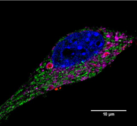 microglia